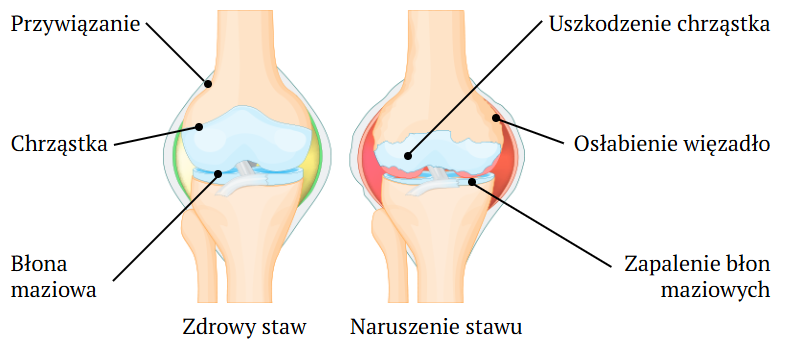 Diagram stawów
